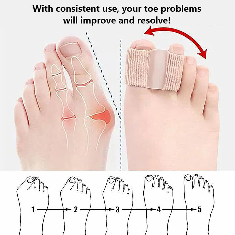 Toe separator for correcting hallux valgus