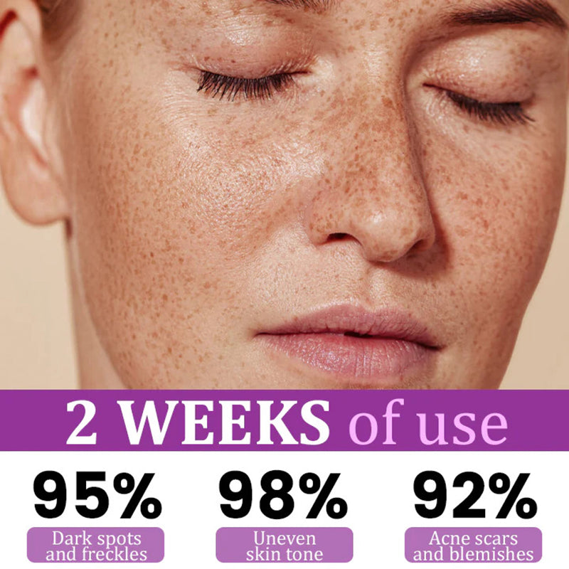 Advanced Anti-Pigmentation Serum