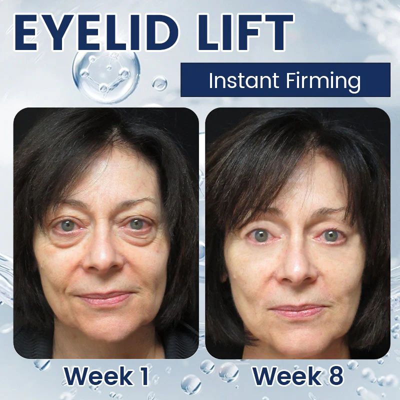 Hydrating and nourishing eye cream(2 pcs)