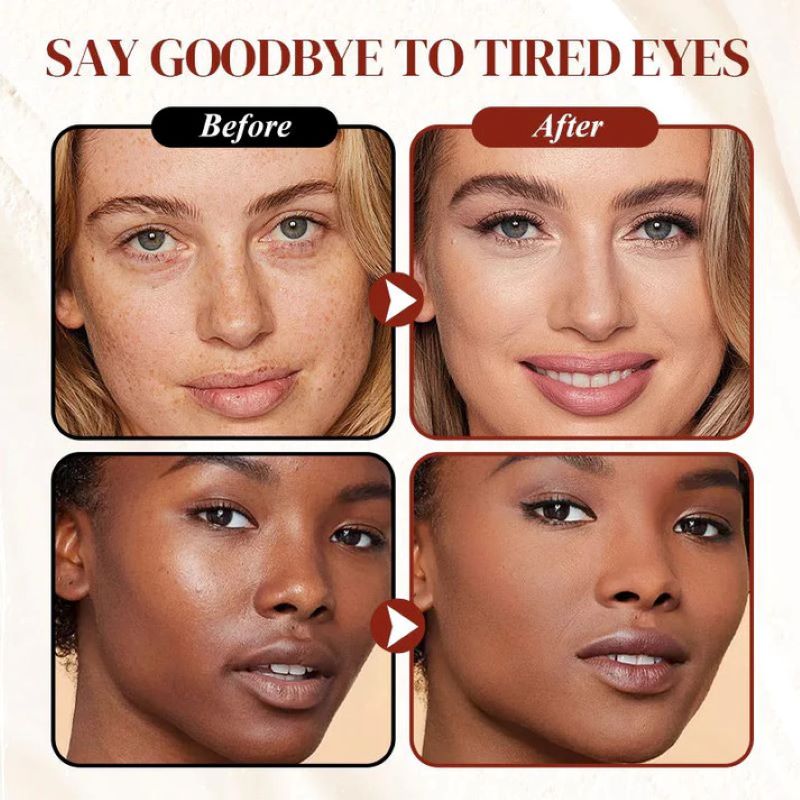 Eye contour concealer