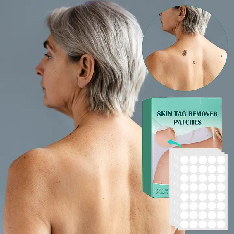 STICKERS FOR THE REMOVAL OF MOLES AND NEVI-Buy 1 Get 1 Free(2 PCS)