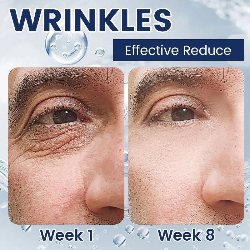 Hydrating and nourishing eye cream(2 pcs)