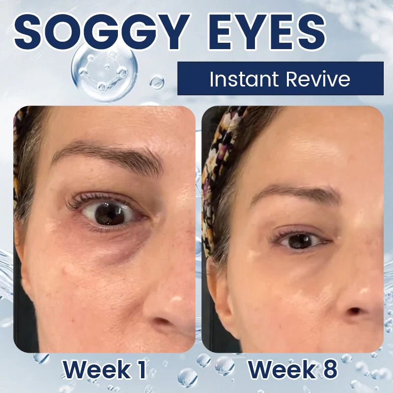 Hydrating and nourishing eye cream(2 pcs)