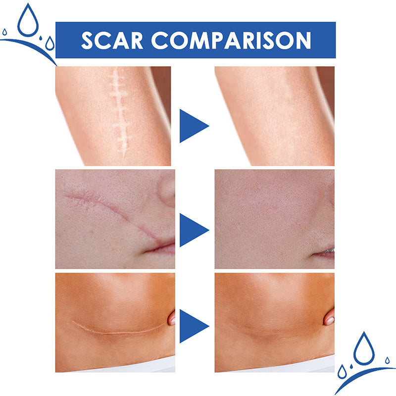 Scar Repair Cream
