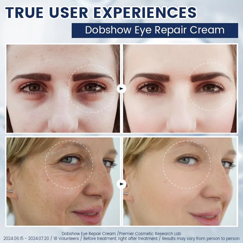 Hydrating and nourishing eye cream(2 pcs)