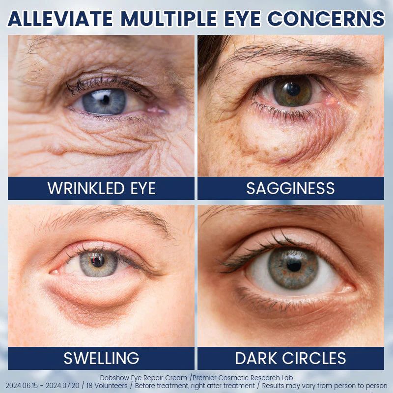 Hydrating and nourishing eye cream(2 pcs)