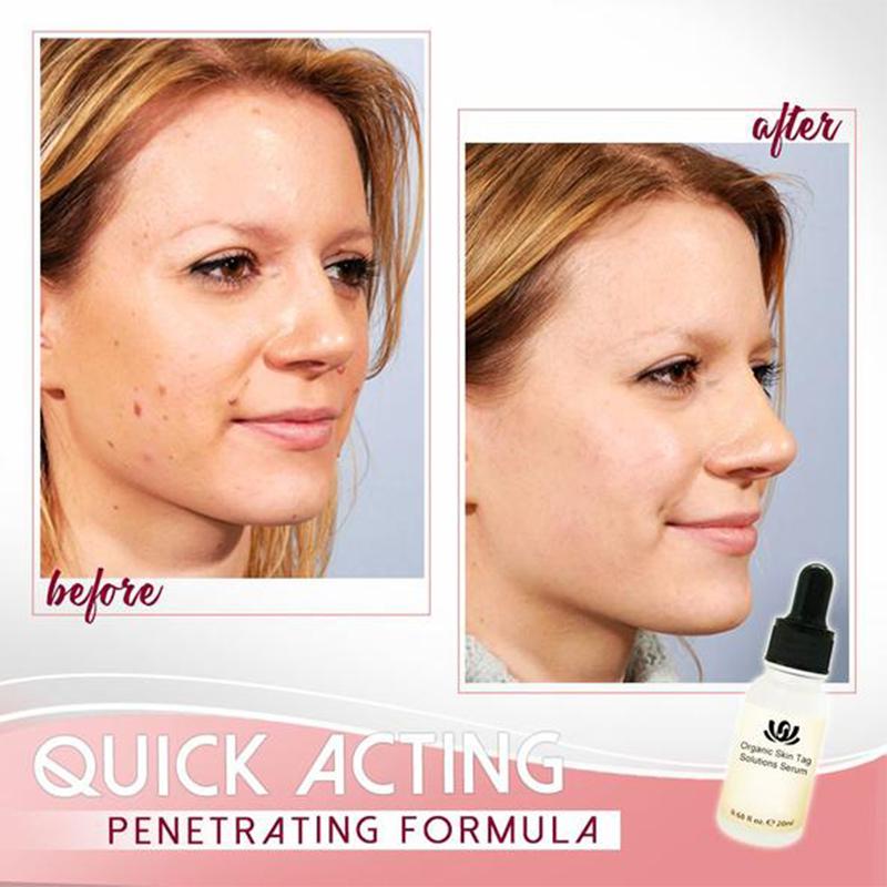 Organic Skin Spot Purifying Serum