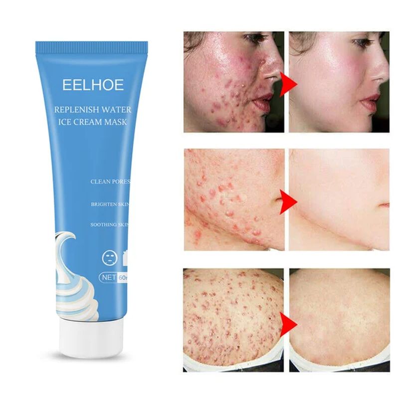 Salicylic Acid Ice Cream Mask (BUY 1 GET 1 FREE)