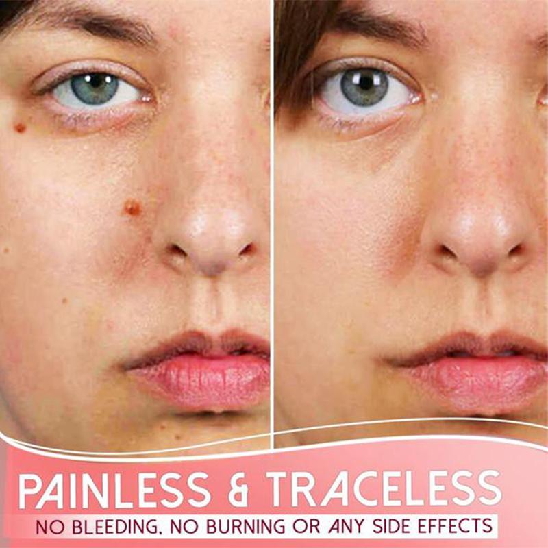 Organic Skin Spot Purifying Serum