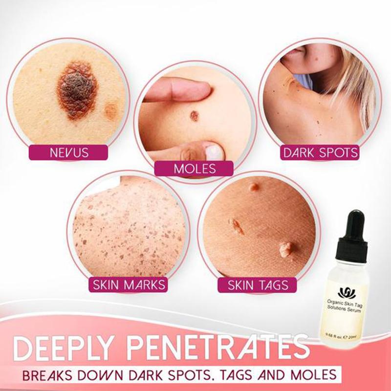 Organic Skin Spot Purifying Serum