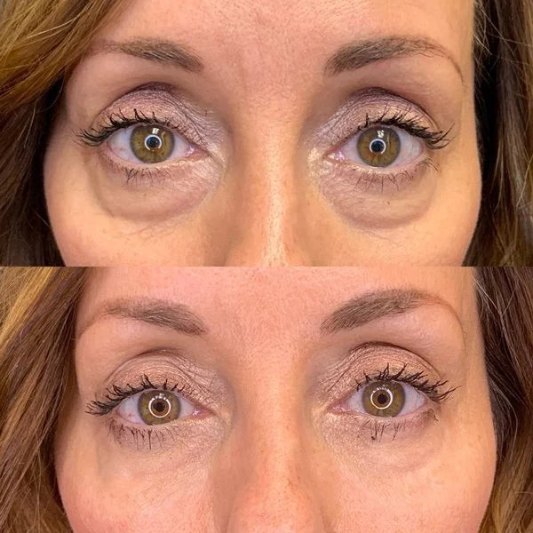 Retinol Anti Aging Face Essence