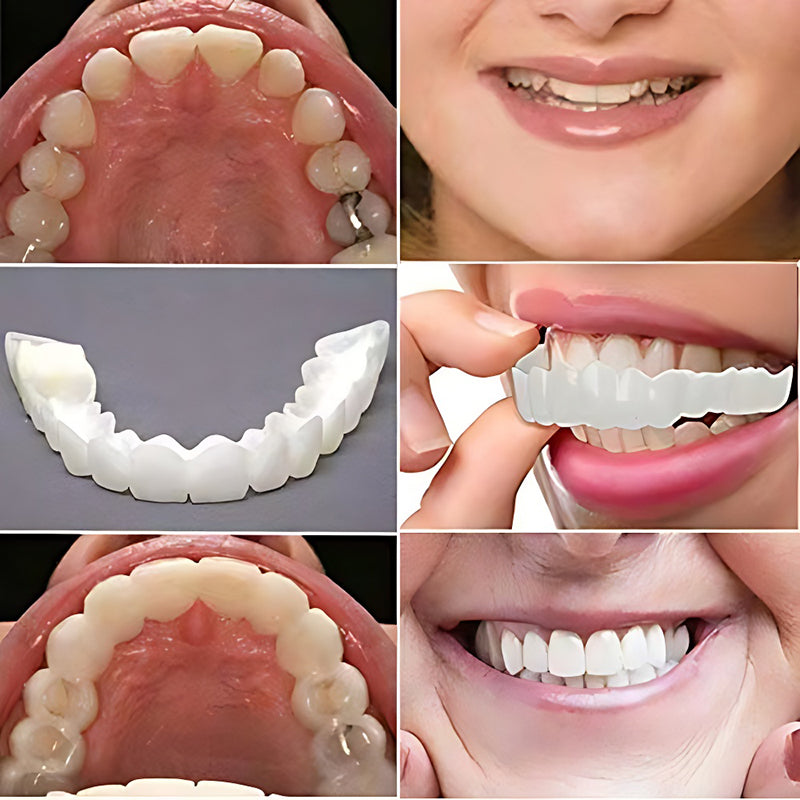 Simulation whitening dentures