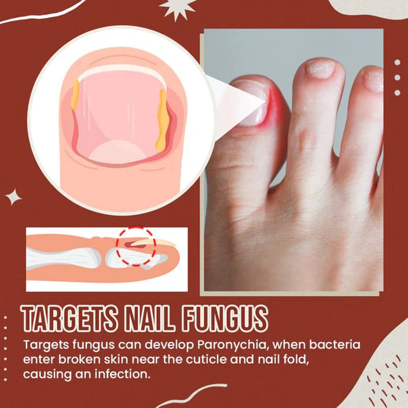 Nail Anti-Fungus Socks