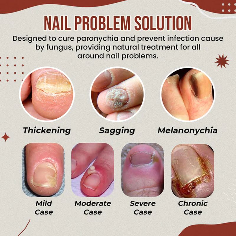 Nail Anti-Fungus Socks