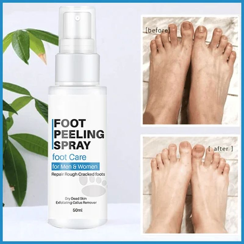 Foot Peeling Spray