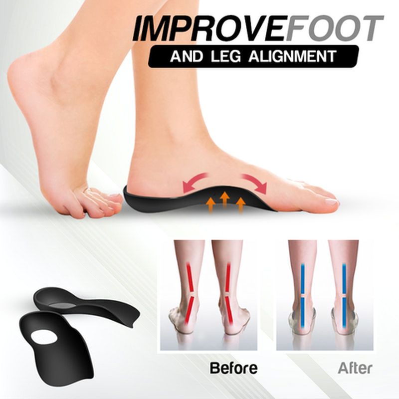 Flat Foot Orthopedic Insoles (1 Pair)