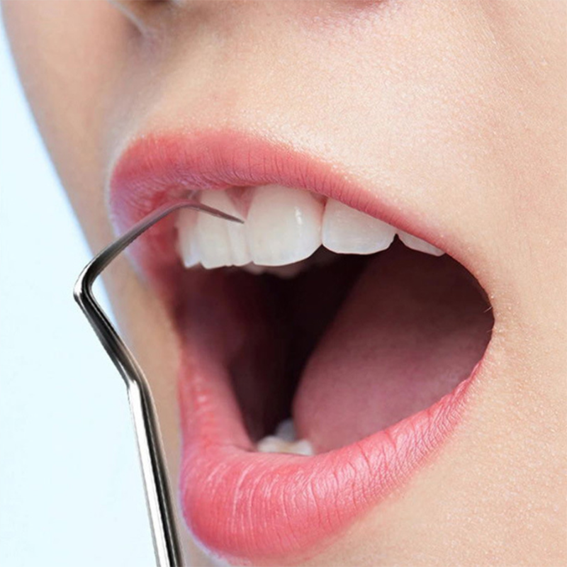 Stainless Steel Teeth Cleaning Tools