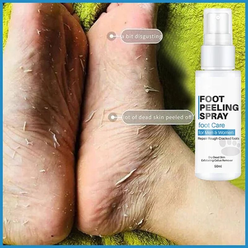 Foot Peeling Spray