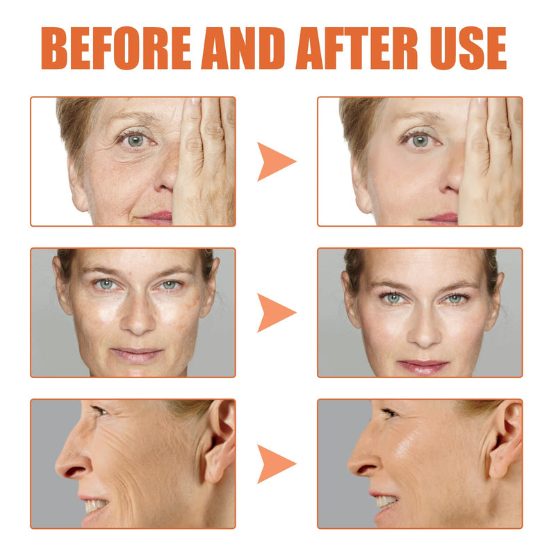 Daily anti-wrinkle serum