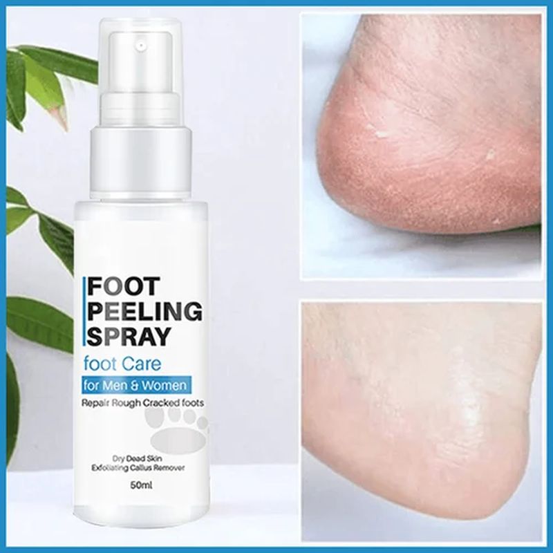 Foot Peeling Spray